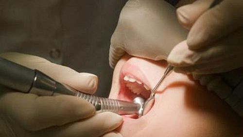 Над 70% от децата до 7 години имат кариес