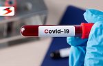 COVID-19 у нас: Положителните проби са близо 7%