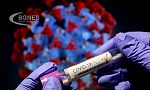 54 са новорегистрираните случаи на коронавирус у нас