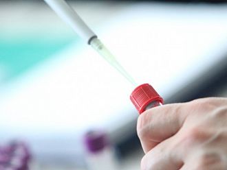 Предполагаем случай на маймунска шарка в Гърция