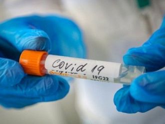 COVID-19: 31 нови случаи и един починал у нас