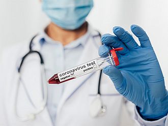 750 са новите случаи на коронавирус у нас