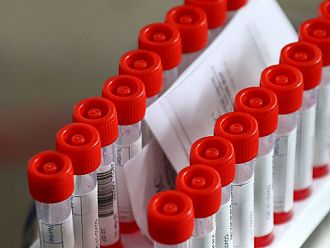 57 са новите случаи на коронавирус