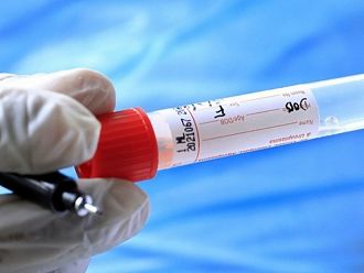 Отново отварят цели клиники за лечение на Covid пациенти в Гърция