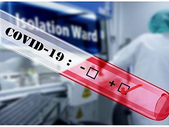 Над 73% от изследвани проби в България доказват британския вариант на COVID-19