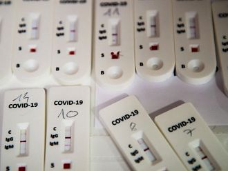 Във Франция вече няма да има безплатни тестове за COVID-19