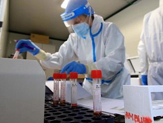 1218 нови случаи на Covid-19 у нас