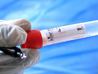 Малко над 5% положителни проби за Covid-19