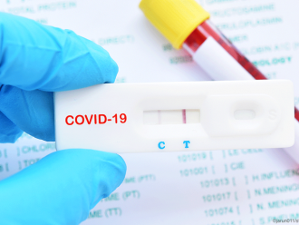 Над хиляда нови случая на коронавирус, положителни са близо 10% от тестовете